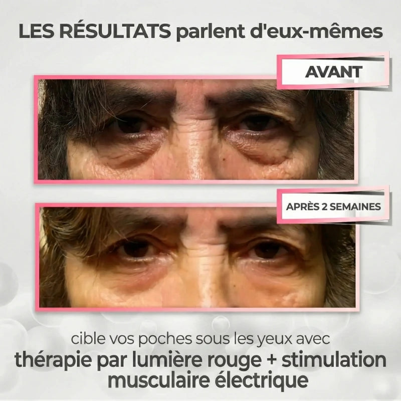 LumiLift™ - Lunettes Red Light + EMS Anti-Poches